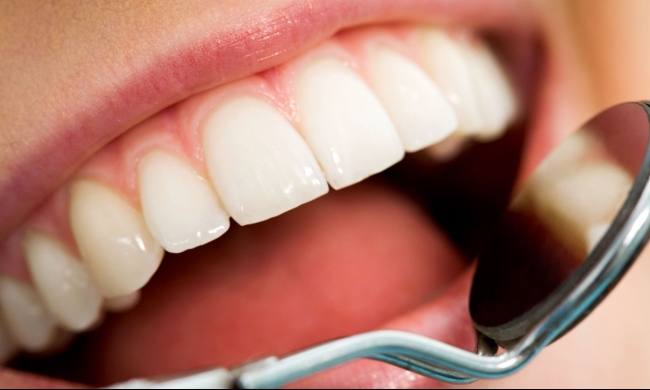 علاج تسوس الأسنان